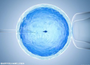 极光生殖